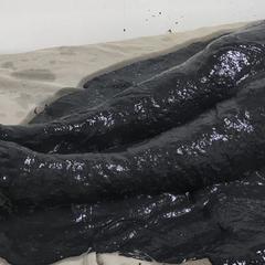 Санаторий им. Чапаева, Ершов, Саратовская область